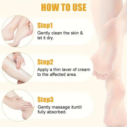 Intensive Repair Moisturizer for Dry Cracked Feet, Heels, Knees & Hands, Dead Skin Remover